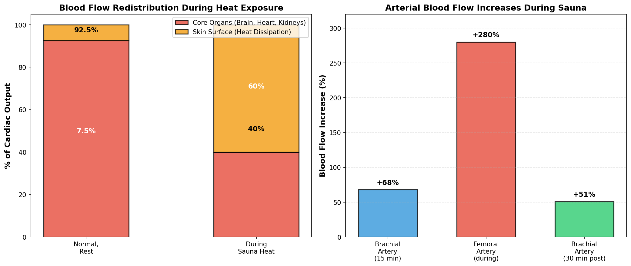Session duration impact on sudden cardiac death reduction
