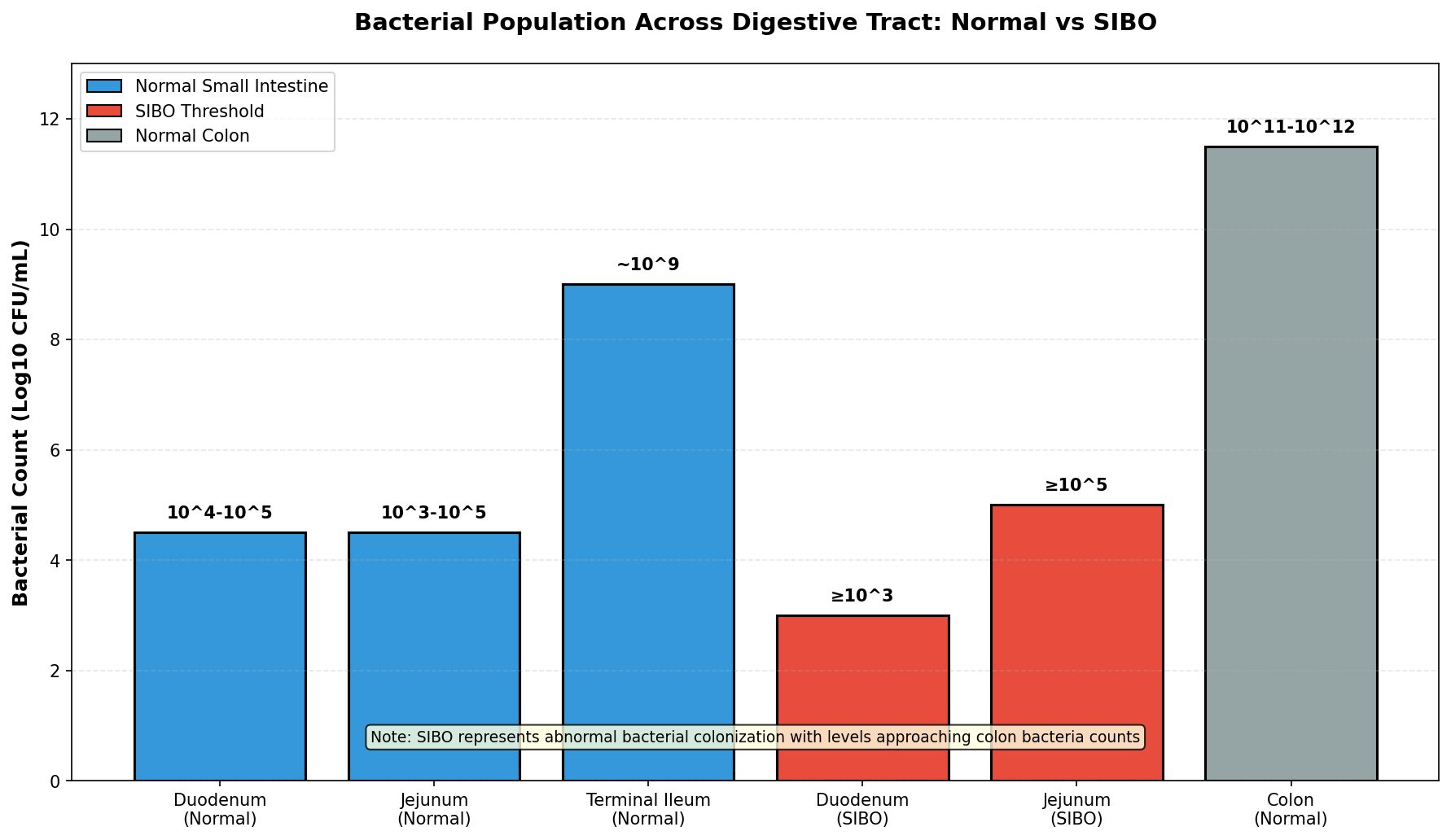 SIBO Prevalence Across Different Populations